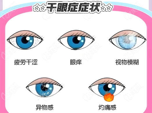 干眼症呈现低龄化趋势 专家呼吁科学使用电子屏