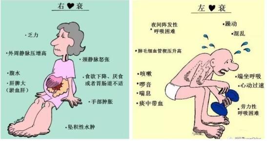 研究：睡眠规律有助于心力衰竭患者康复